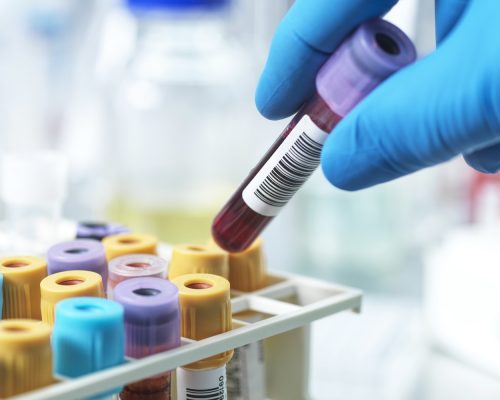 260105-blood-samples-rs-919aaa