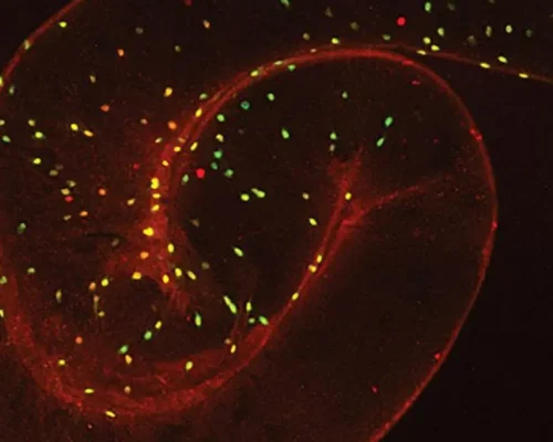 Gut-image-Courtesy-of-Marc-Tatar-1024x683