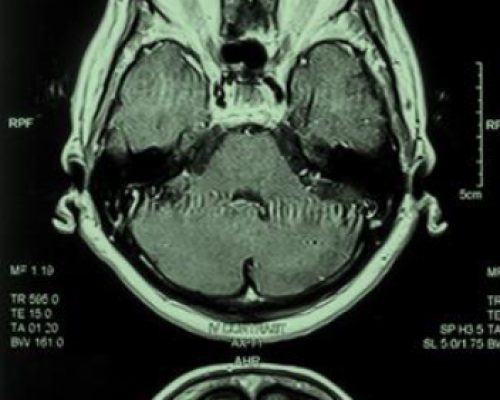 Screenshot 2024-11-03 at 10-10-28 The Coming Alzheimer's Disease Healthcare Revolution Survey Report - The-Coming-Alzheimer's-Disease-Healthcare-Revolution-Survey-Report.PDF