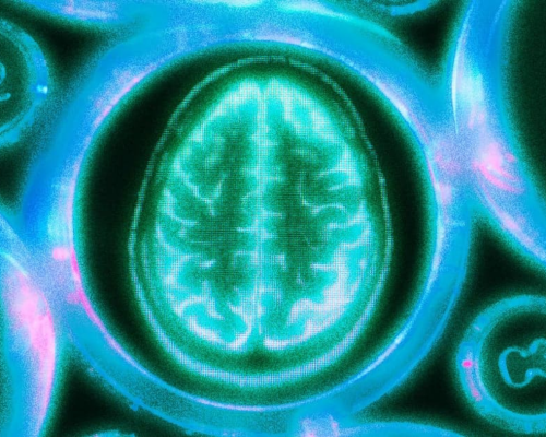 Screenshot 2025-01-11 at 17-38-11 dementia.jpeg (JPEG Image 1200 × 630 pixels)