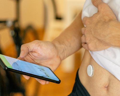 continuous-monitor-lactate_h