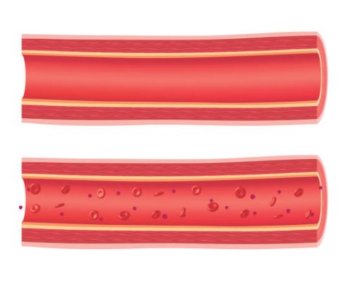 Anatomical vessels with blood cells and clean