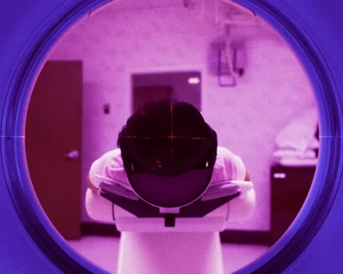 mri-scan-contrast-dye-toxic